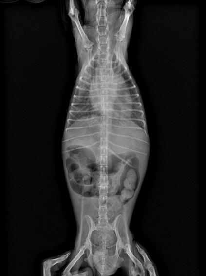 abdomen.jpg