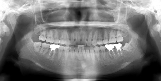 dental_4.jpg